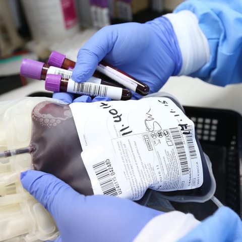Zdjęcie: Młode osocze i krew — mit czy obiecujący kierunek w longevity