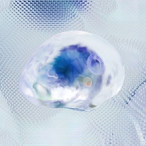 Zdjęcie: Jak działa implant mózgowy Neuralink — zasada i pierwsze wyniki